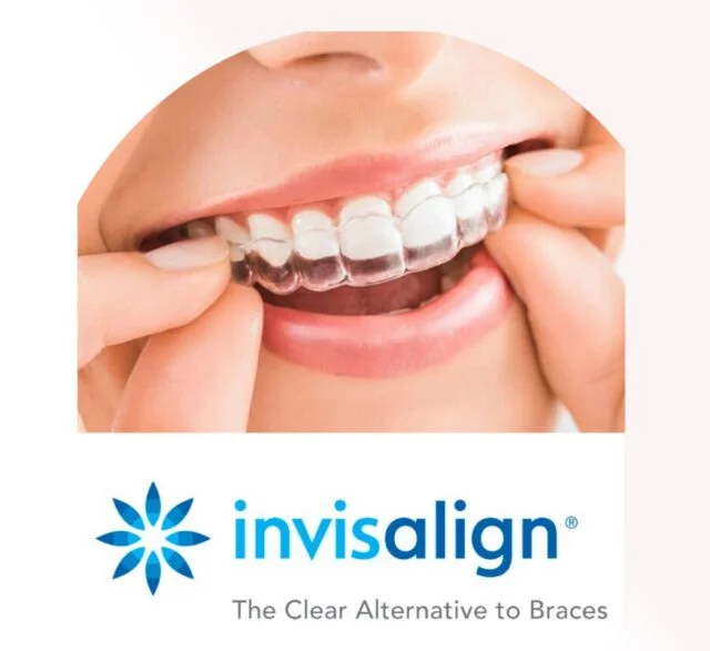 Invisalign