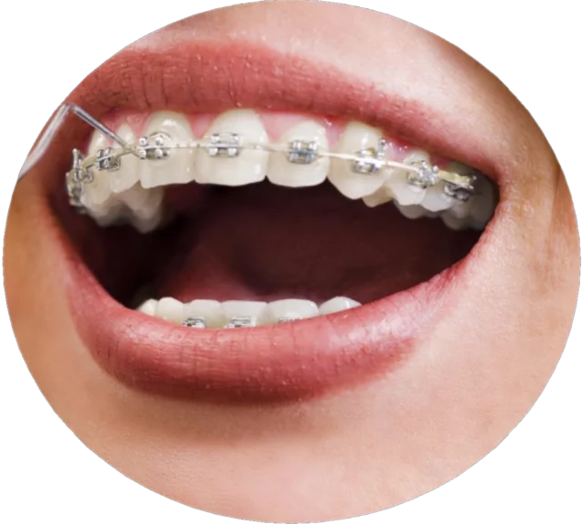 Orthodontie